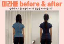 선천적인 척추측만,필라테스로 교정 가능할까?