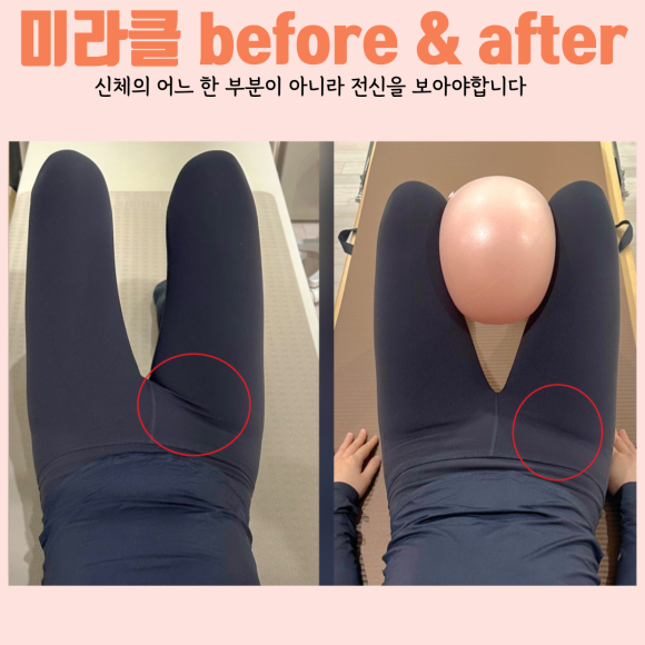 제목을-입력해주세요_-006